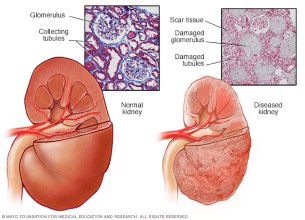 What Is Nephrology?