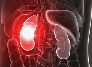 Renal Nutrition and Dietetics: Supporting Kidney-Friendly 
                Nutrition